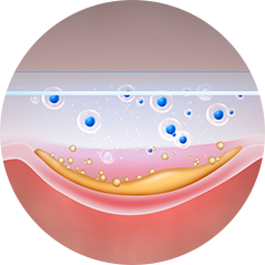 울쎄라피 프라임 특징4